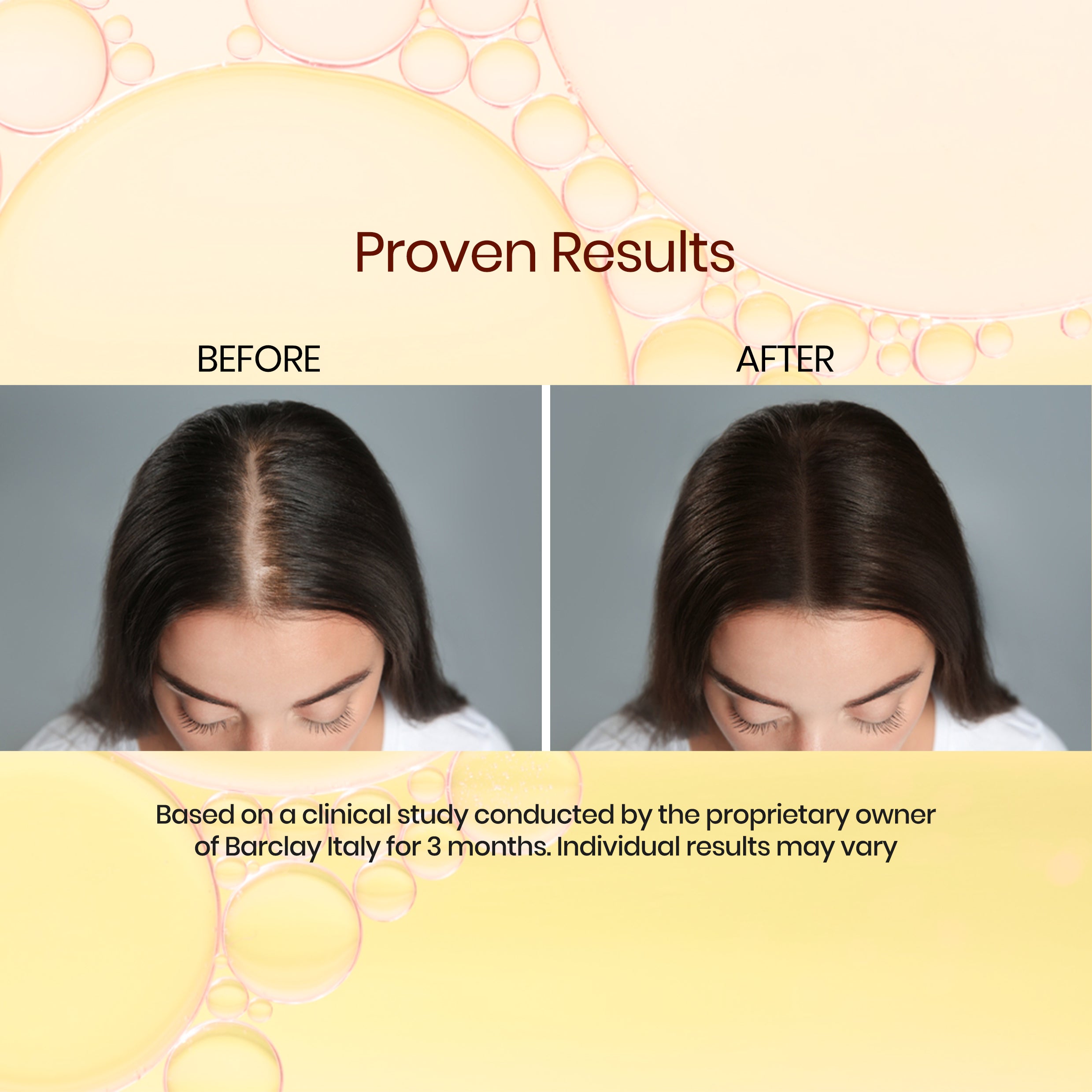 Barclay Italy Ultimate hair growth serum